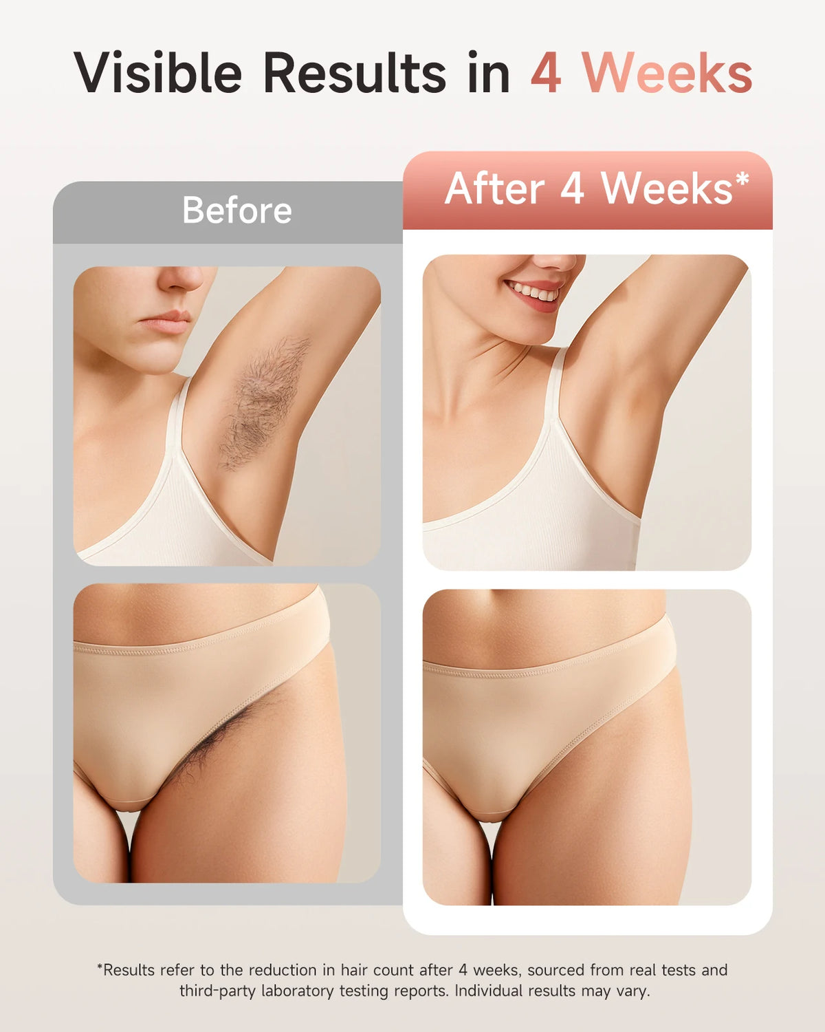 LYSMOSKI IPL Hair Removal Device With Skin Rejuvenation Acne Treatment